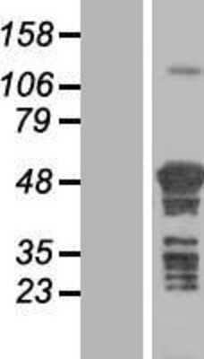 Western Blot: TSPYL4 Overexpression Lysate [NBL1-17388]