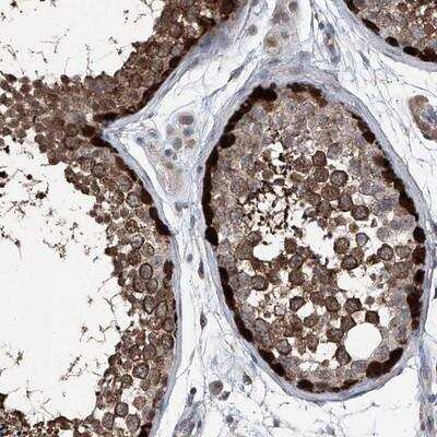 Immunohistochemistry: TSPYL5 Antibody [NBP1-93578]