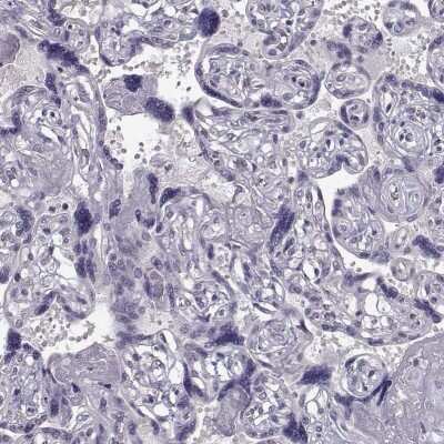 Immunohistochemistry-Paraffin: TSPYL5 Antibody [NBP1-93578]