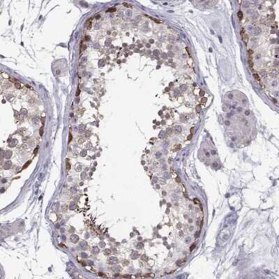 Immunohistochemistry-Paraffin: TSPYL5 Antibody [NBP1-93578]