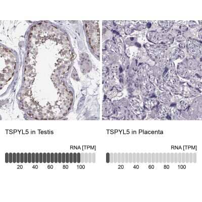 Immunohistochemistry-Paraffin: TSPYL5 Antibody [NBP1-93578]