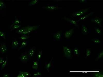 Immunocytochemistry/ Immunofluorescence: TSPYL6 Antibody [H00388951-B01P]