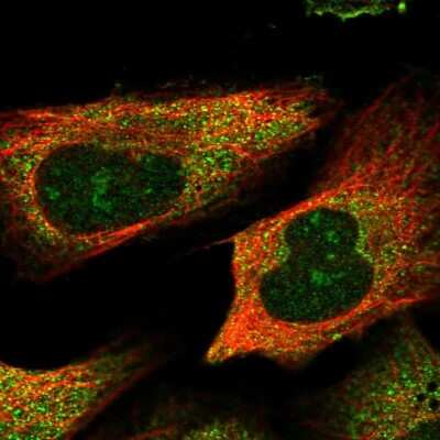 Immunocytochemistry/ Immunofluorescence: TSPYL6 Antibody [NBP2-33977]