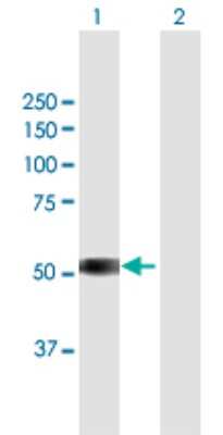 Western Blot: TSPYL6 Antibody [H00388951-B01P]