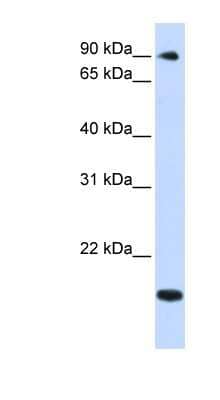 Western Blot: TSR1 Antibody [NBP1-55349]