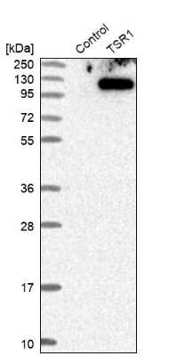 Western Blot: TSR1 Antibody [NBP1-84619]