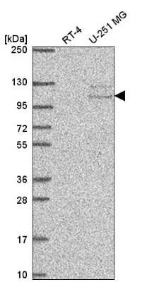 Western Blot: TSR1 Antibody [NBP2-58300]