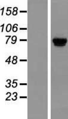 Western Blot: TSR1 Overexpression Lysate [NBL1-17389]