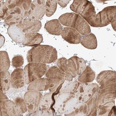 Immunohistochemistry-Paraffin: TSR2 Antibody [NBP1-84050]