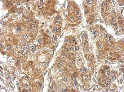 Immunohistochemistry-Paraffin: TSR2 Antibody [NBP2-20750]