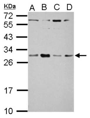 Western Blot: TSR2 Antibody [NBP2-20750]