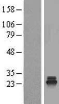 Western Blot: TSR2 Overexpression Lysate [NBL1-17390]