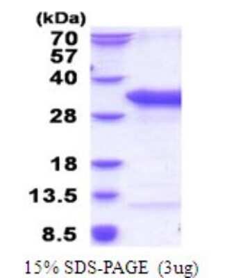 SDS-PAGE: Recombinant Human TSR2 His Protein [NBP2-51821]