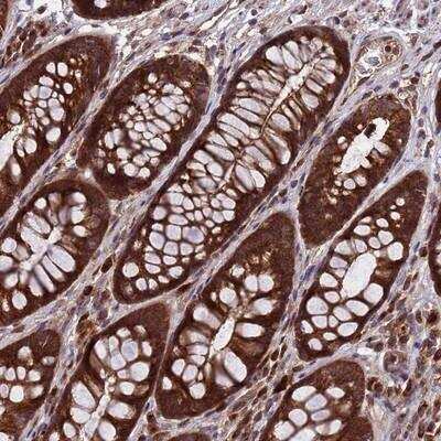 Immunohistochemistry-Paraffin: TSR3 Antibody [NBP1-93502]