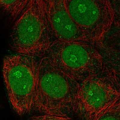 Immunocytochemistry/ Immunofluorescence: TSSC1 Antibody [NBP2-58684]