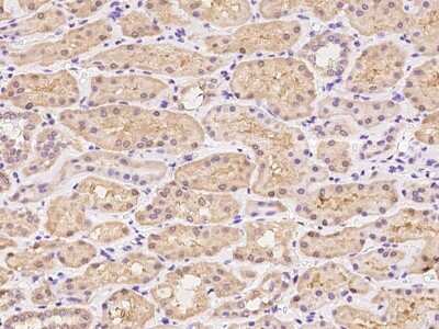 Immunohistochemistry-Paraffin: TSSC1 Antibody [NBP2-97962]