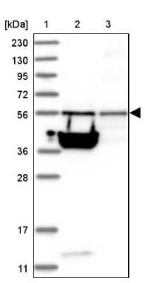 Western Blot: TSSC1 Antibody [NBP1-85927]