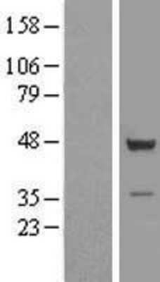 Western Blot: TSSC1 Overexpression Lysate [NBL1-17391]