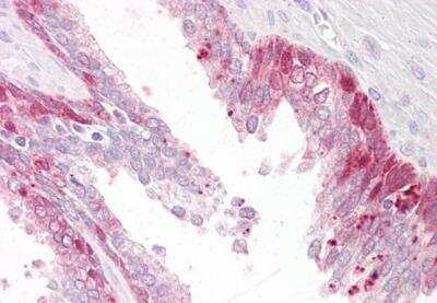 Immunohistochemistry-Paraffin: TSSC3 Antibody [NB100-1347]