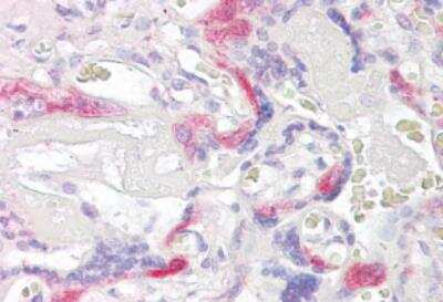 Immunohistochemistry-Paraffin: TSSC3 Antibody [NB100-1347]