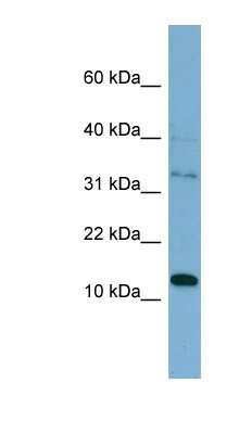 Western Blot: TSSC3 Antibody [NBP1-59088]