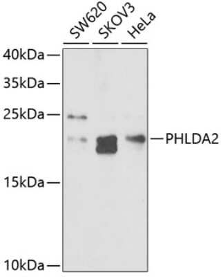 Western Blot: TSSC3 AntibodyBSA Free [NBP2-93728]