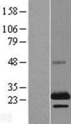 Western Blot: TSSC3 Overexpression Lysate [NBL1-14368]