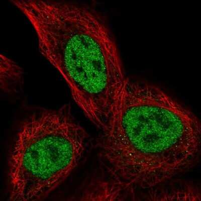 Immunocytochemistry/ Immunofluorescence: TSSC4 Antibody [NBP2-55360]