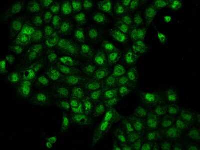 Immunocytochemistry/ Immunofluorescence: TSSC4 Antibody [NBP2-98057]