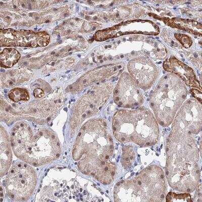 Immunohistochemistry-Paraffin: TSSC4 Antibody [NBP1-85838]