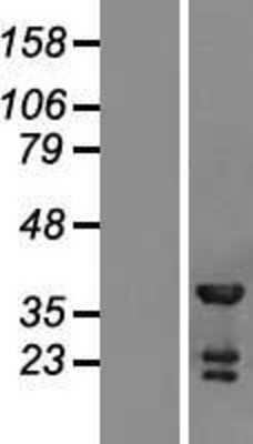 Western Blot: TSSC4 Overexpression Lysate [NBL1-17392]