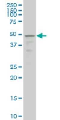 Western Blot: TSSK1 Antibody (2E8) [H00083942-M02]