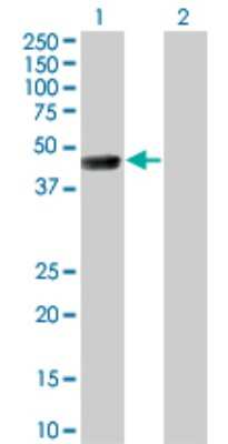 Western Blot: TSSK1 Antibody (4F12) [H00083942-M01]