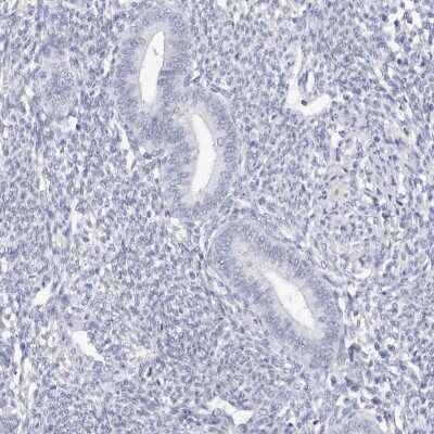 Immunohistochemistry-Paraffin: TSSK1 Antibody [NBP1-83883]