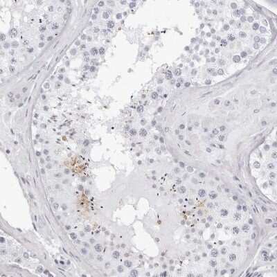 Immunohistochemistry-Paraffin: TSSK1 Antibody [NBP1-83883]