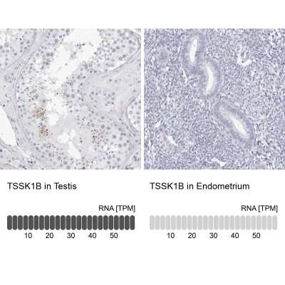 Immunohistochemistry-Paraffin: TSSK1 Antibody [NBP1-83883]