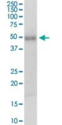 Western Blot: TSSK1 Antibody [H00083942-D01P]