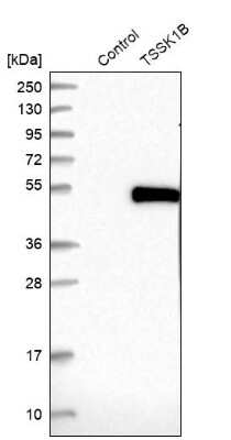 Western Blot: TSSK1 Antibody [NBP1-83883]