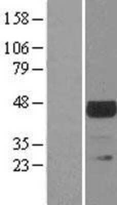 Western Blot: TSSK1 Overexpression Lysate [NBL1-17393]