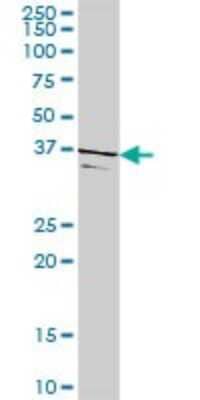 Western Blot: TSSK2 Antibody [H00023617-D01P]