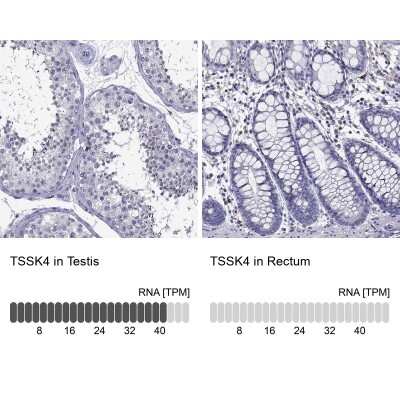 Immunohistochemistry-Paraffin: TSSK4 Antibody [NBP2-62713]