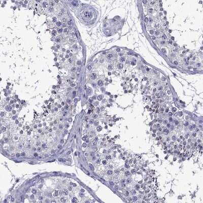 Immunohistochemistry-Paraffin: TSSK4 Antibody [NBP2-62713]