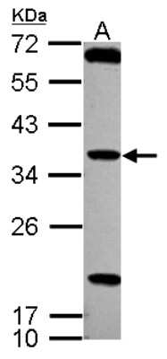 Western Blot: TSSK4 Antibody [NBP2-20751]