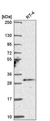 Western Blot: TSSK4 Antibody [NBP2-56284]