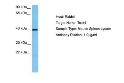 Western Blot: TSSK4 Antibody [NBP2-88506]