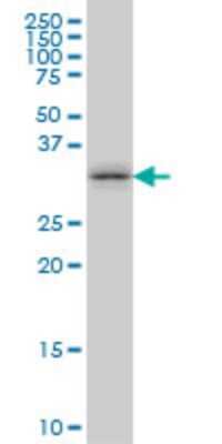 Western Blot: TSSK6 Antibody (6F5) [H00083983-M02]