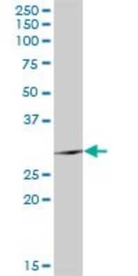 Western Blot: TSSK6 Antibody [H00083983-D01P]