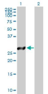 Western Blot: TSSK6 Antibody [H00083983-D01P]