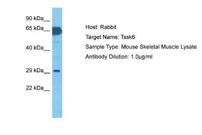 Western Blot: TSSK6 Antibody [NBP2-86880]