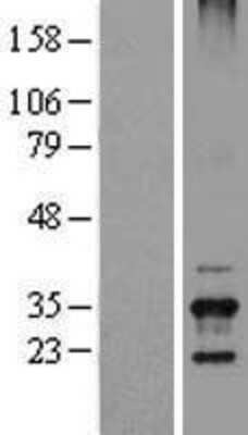 Western Blot: TSSK6 Overexpression Lysate [NBL1-17395]